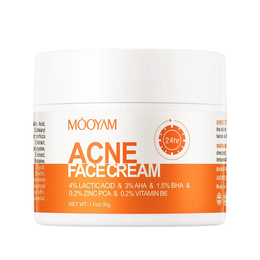 Acne Treatment Cream Oil Control