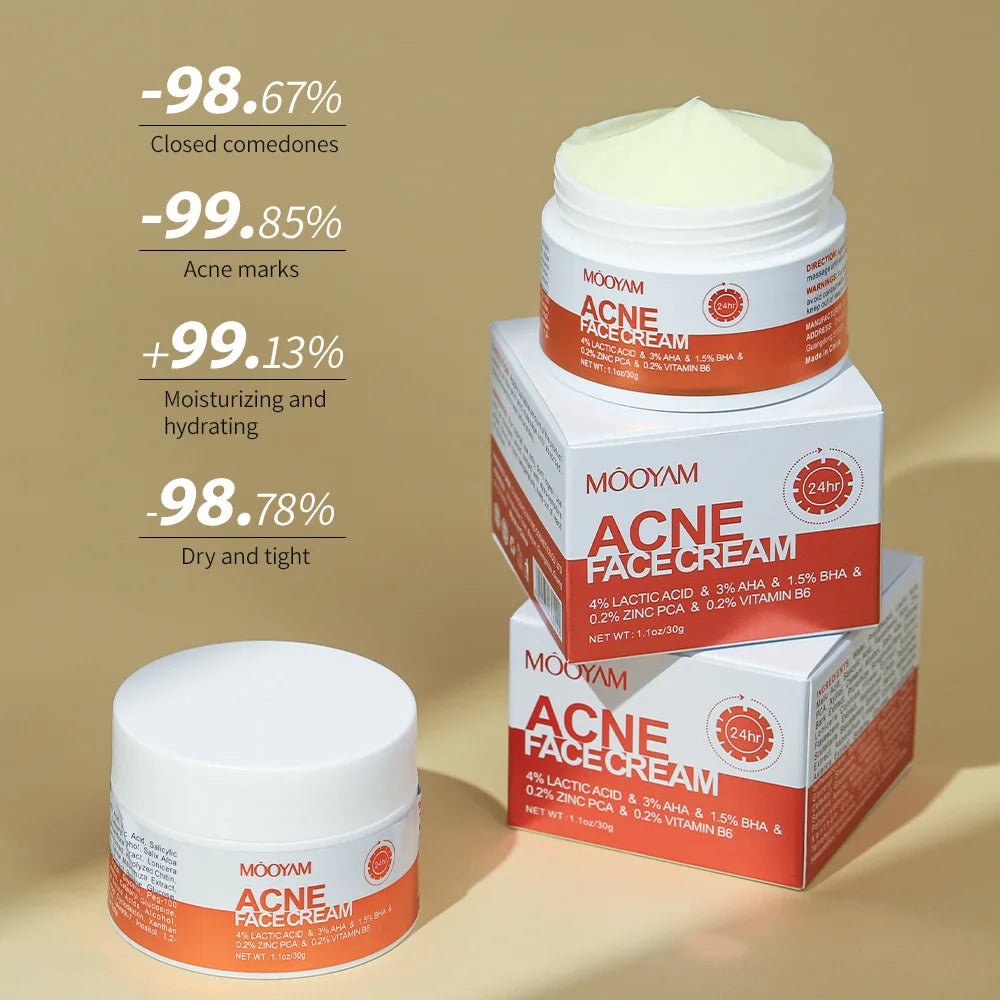 Acne Treatment Cream Oil Control