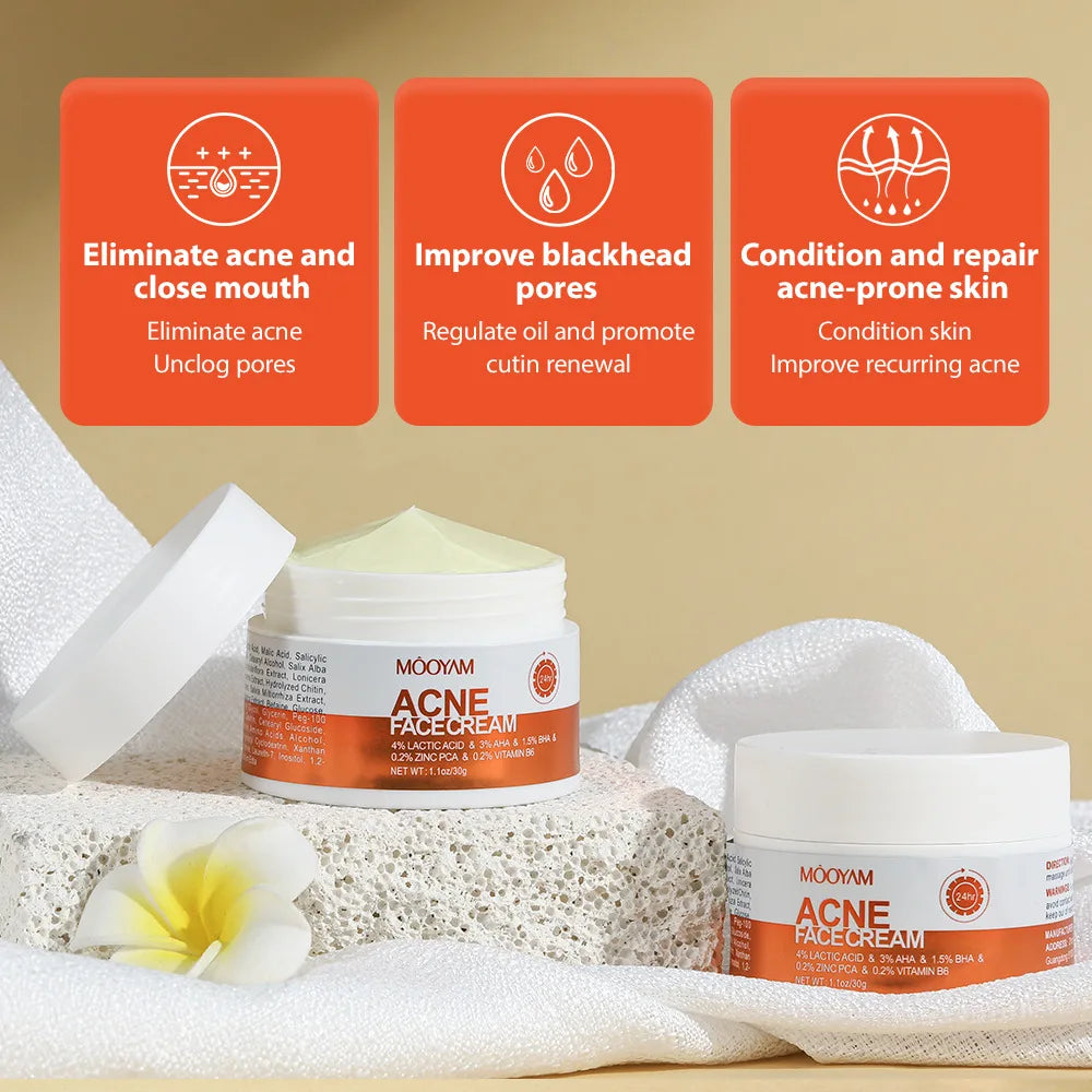 Acne Treatment Cream Oil Control