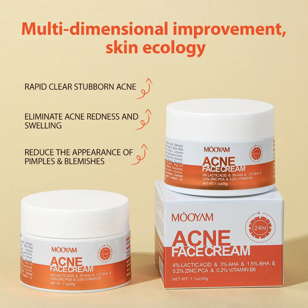 Acne Treatment Cream Oil Control