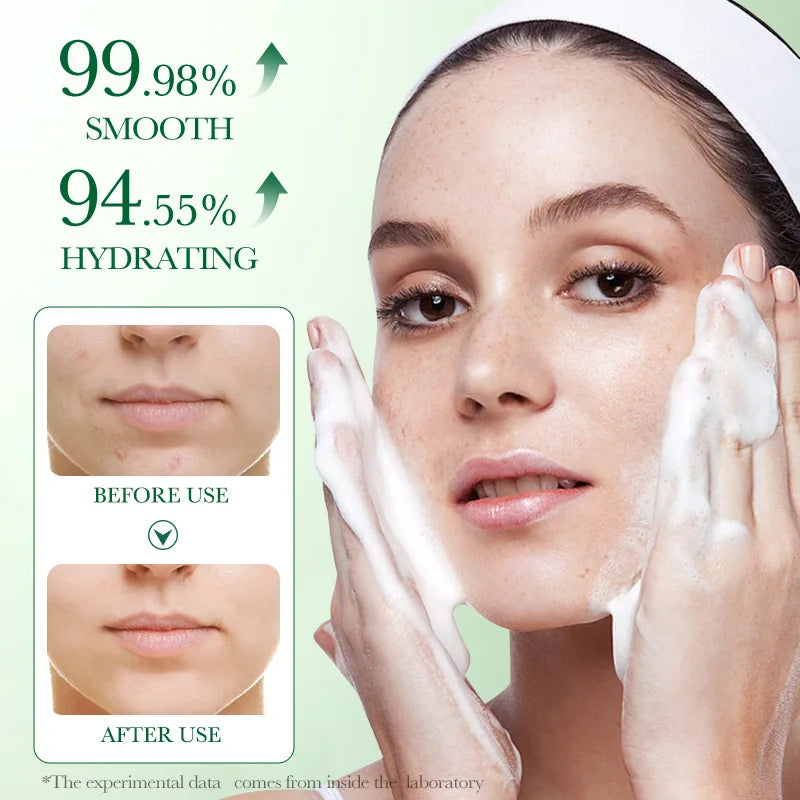 Anti-Acne & Oil Control Bioaqua Centella Asiatica Cleanser